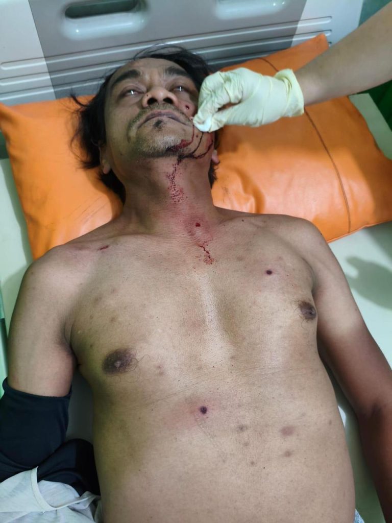 Diduga Ingkar Janji, Pria di Prigen Tembaki Warga Pakai Airsoft Gun