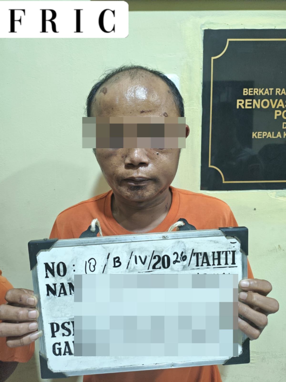 Polisi Tahan Tersangka Kasus Kekerasan Seksual terhadap Anak